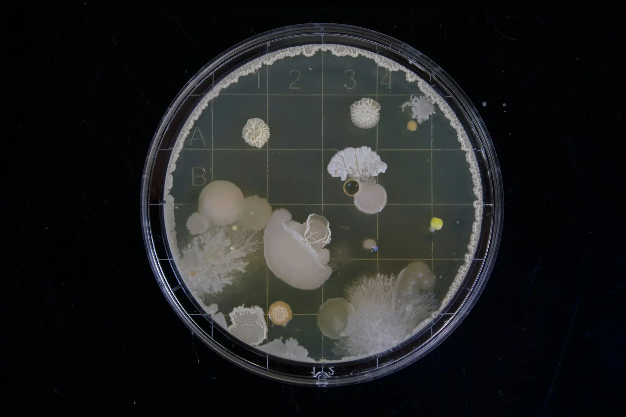 A petri dish with abstract bacterial colonies in a grid pattern, evoking clinical research.